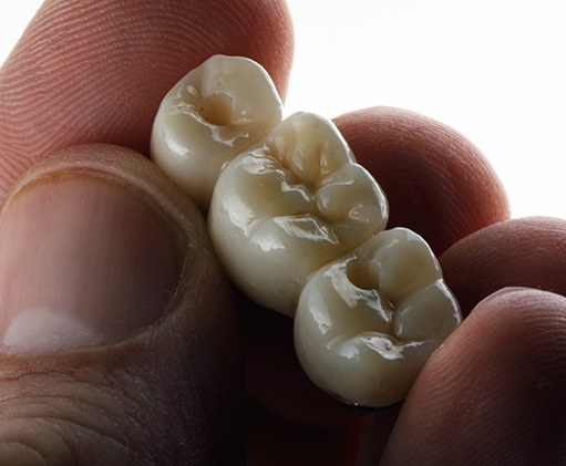 Closeup of fingers holding dental bridge