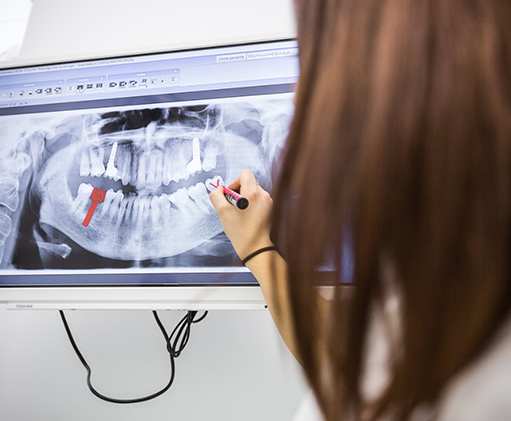 Dentist showing a patient an x ray of their teeth