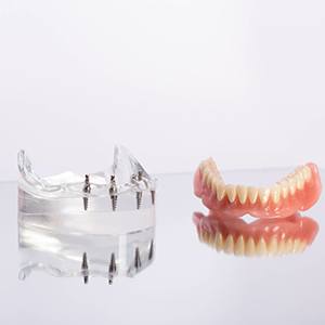 a close-up of an implant dentures