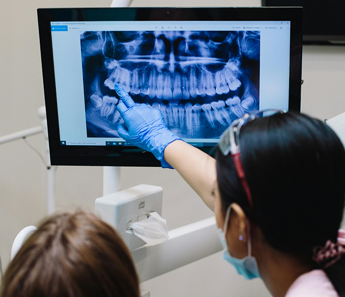 Dentist showing a patient an x ray of their teeth