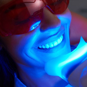 Woman undergoing in-office teeth whitening treatment